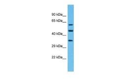OR4F6 Rabbit anti-Human, Polyclonal, Novus Biologicals 100 &mu;g | Buy Online | Novus Biologicals | Fisher Scientific